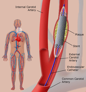 Does walking cause pain in the legs? Any problems with digestion or 